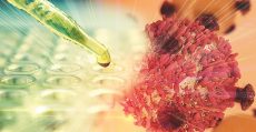 accesul-la-terapiile-imuno-oncologice-necesitatea-unei-noi-abordari