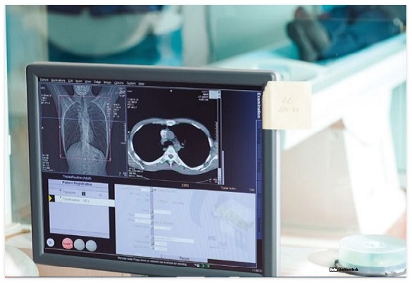 abordarea-integrata-a-patologiei-oncologice