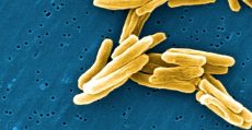 Mycobacterium tuberculosis (bacilul Koch)