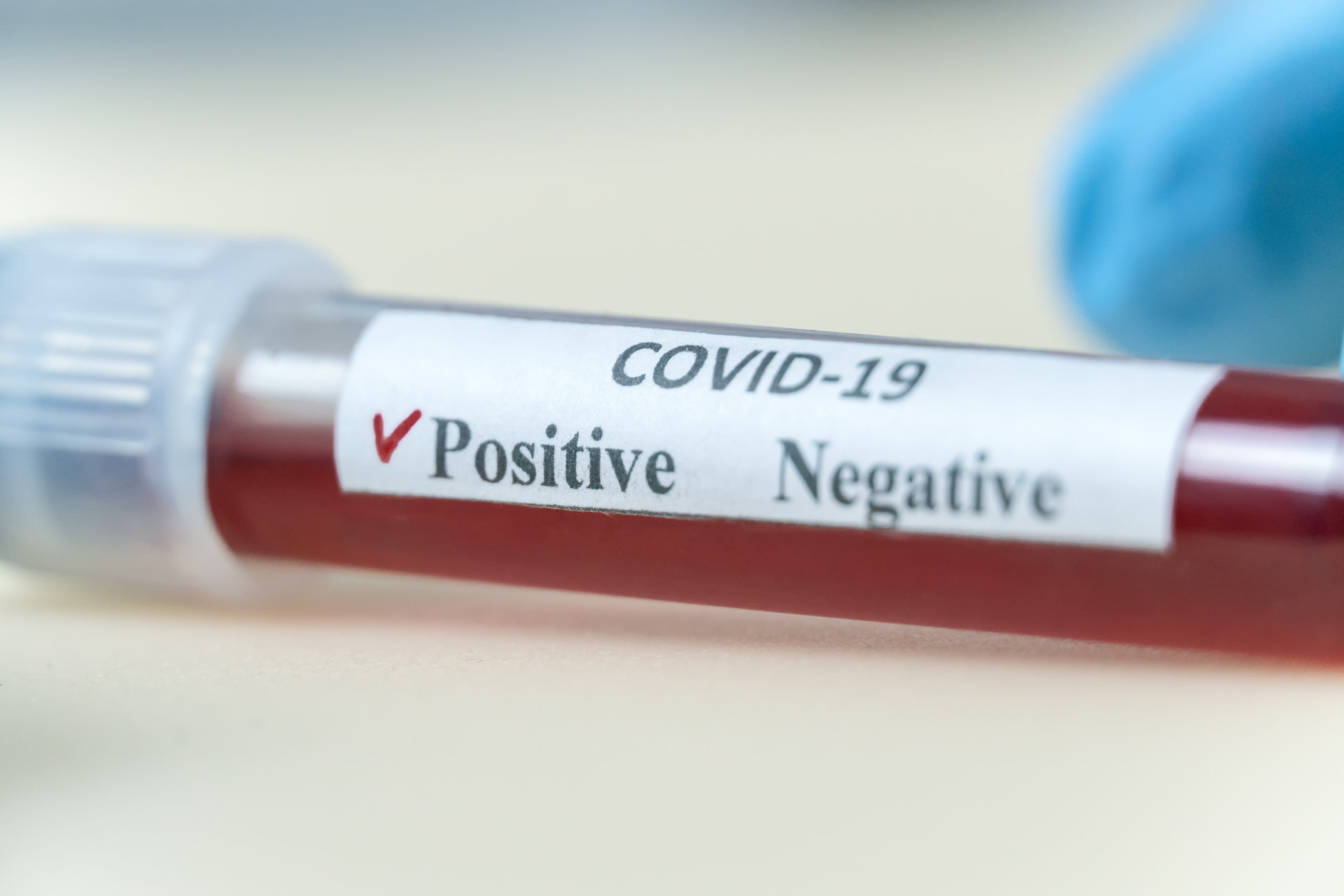 Test COVID-19